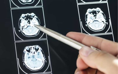 Τι Λένε οι Νευροεπιστήμες για την Ύπνωση και τον Εγκέφαλο